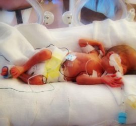 Have you ever met a NICU Mom? She may look strong and brave, but her heart sings a sad melody longing to care for her baby and expecting a miracle!
