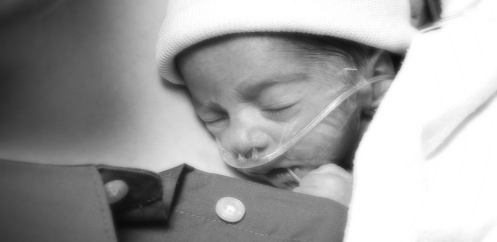 What is Kangaroo Care or Skin-to-Skin Care? Why is it important for your baby? Read more to apprehend the benefits of Kangaroo Care for your baby.