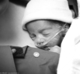 What is Kangaroo Care or Skin-to-Skin Care? Why is it important for your baby? Read more to apprehend the benefits of Kangaroo Care for your baby.